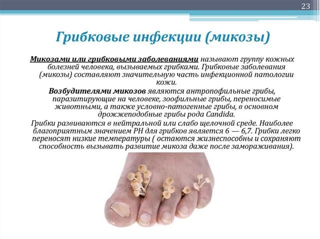 Что такое грибковая инфекция Что такое грибковая инфекция